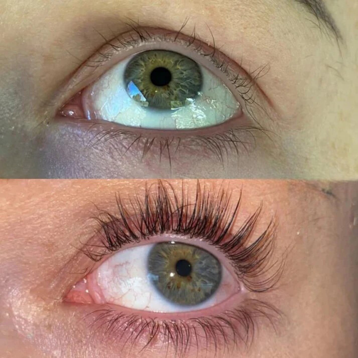 Eyelash Growth Serum